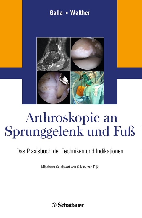 Arthroskopie an Sprunggelenk und Fuß - 