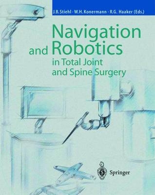 Navigation and Robotics in Total Joint and Spine Surgery - 