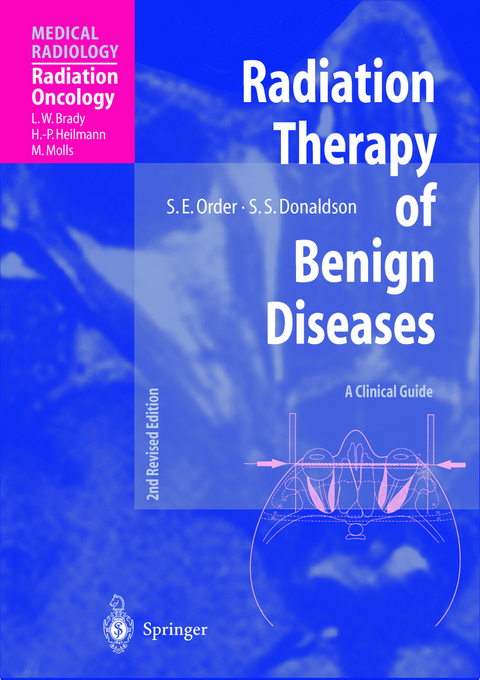 Radiation Therapy of Benign Diseases - Stanley E. Order, Sarah S. Donaldson