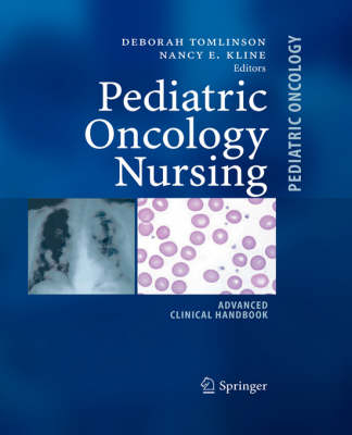 Pediatric Oncology Nursing; Advanced Clinical Handbook - 