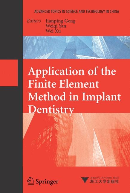 Application of the Finite Element Method in Implant Dentistry - 