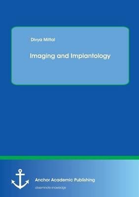 Imaging and Implantology - Divya Mittal