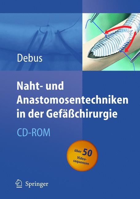 Naht- und Anastomosentechniken in der Gefäßchirurgie - Eike S. Debus