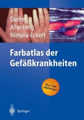 Farbatlas der Gefäßkrankheiten - C. Diehm, J. R. Allenberg, K. Nimura-Eckert