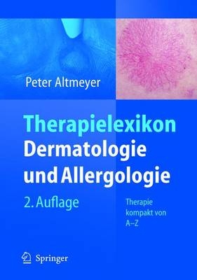 Therapielexikon Dermatologie und Allergologie - Peter Altmeyer