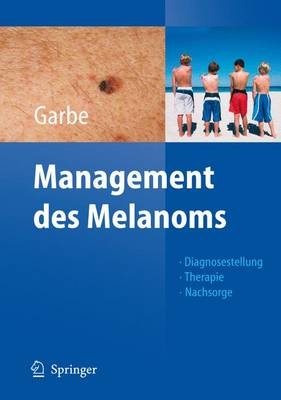 Management des Melanoms - 