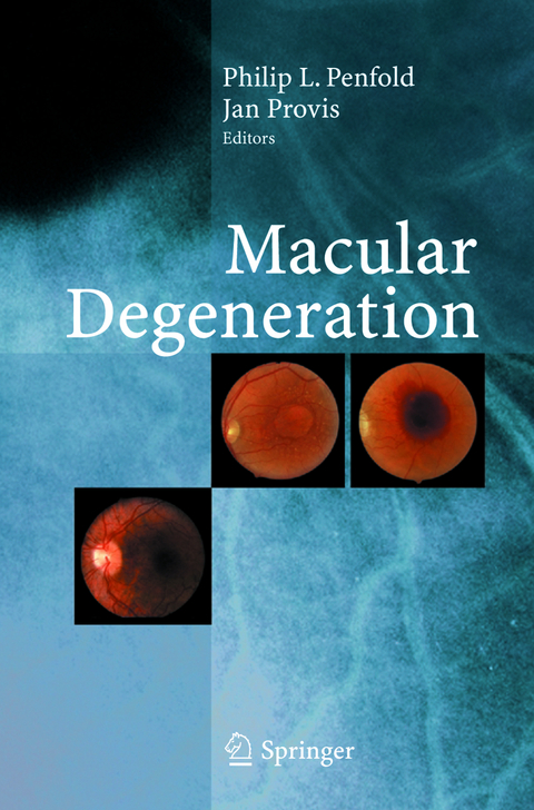 Macular Degeneration - 