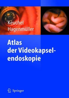 Atlas der Videokapselendoskopie - 