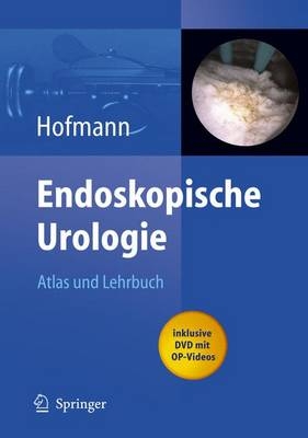 Endoskopische Urologie - 