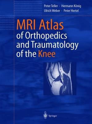 MRI Atlas of Orthopedics and Traumatology of the Knee - Peter Teller, Hermann König, Ulrich Weber, Peter Hertel