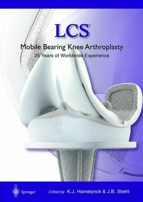 LCS Mobile Bearing Knee Arthroplasty - 