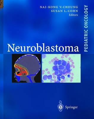 Neuroblastoma - 