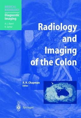 Radiology and Imaging of the Colon