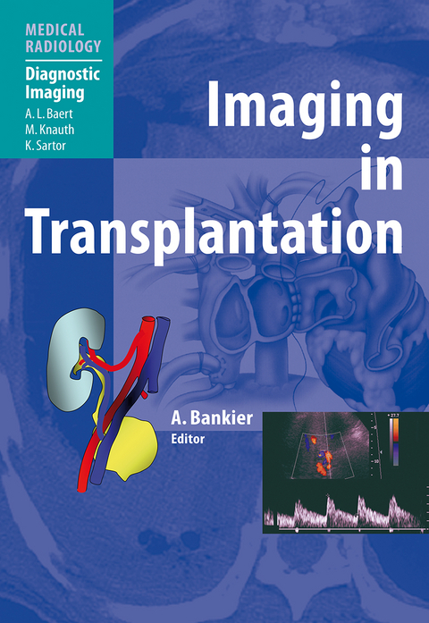 Imaging in Transplantation - 