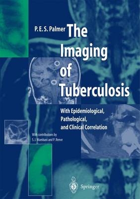 The Imaging of Tuberculosis - P. E. Palmer