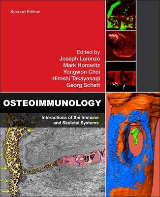 Osteoimmunology - 