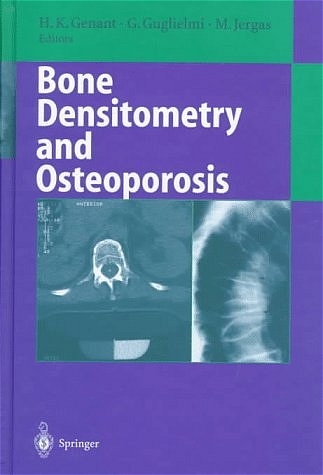 Bone Densitometry and Osteoporosis - 