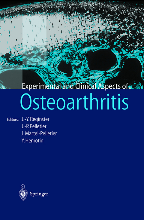 Osteoarthritis - 