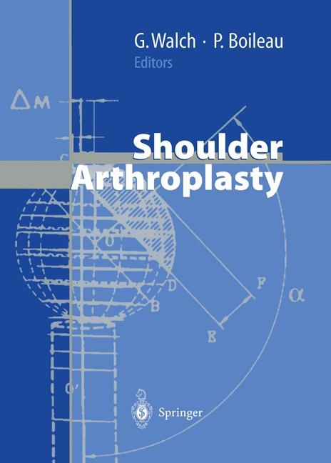 Shoulder Arthroplasty - 