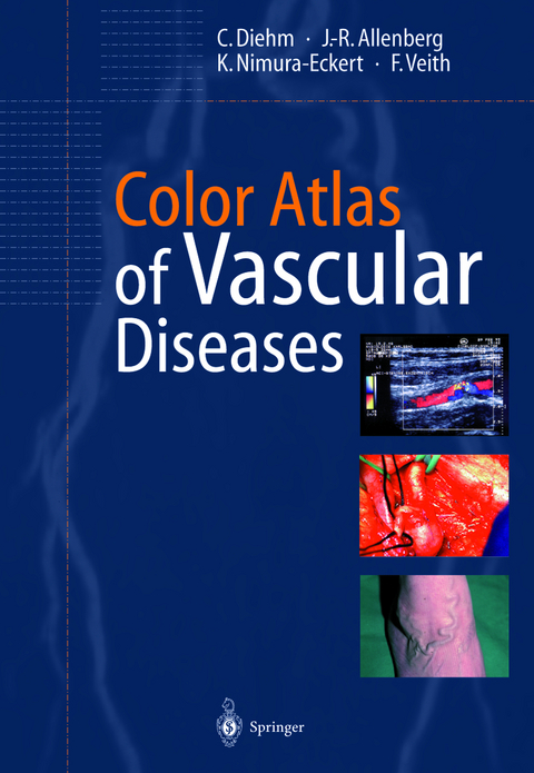 Color Atlas of Vascular Diseases - C. Diehm, J.-R. Allenberg, K. Nimura-Eckert, F.J. Veith