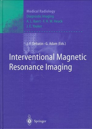 Interventional Magnetic Resonance Imaging - 