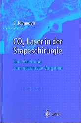 CO2-Laser in der Stapeschirurgie - Sergije Jovanovic