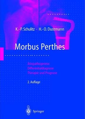 Morbus Perthes - Klaus P. Schulitz, Hans O. Dustmann