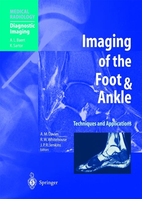 Imaging of the Foot and Ankle - 