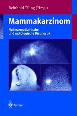 Mammakarzinom - 