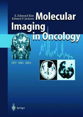 Molecular Imaging in Oncology - E. Edmund Kim, Edward F. Jackson