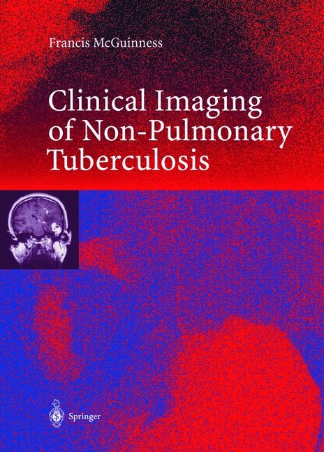 Clinical Imaging in Non-Pulmonary Tuberculosis - Francis E. McGuinness