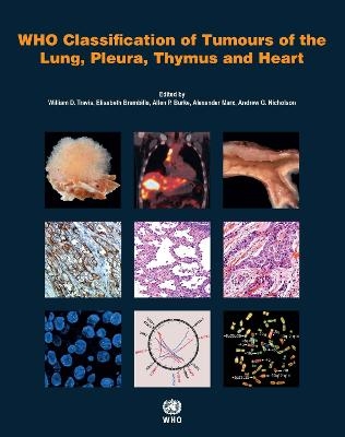 WHO Classification of Tumours of the Lung, Plura, Thymus and Heart -  International Agency for Research on Cancer,  World Health Organization,  International Academy of Pathology