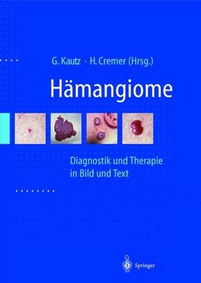 Hämangiome