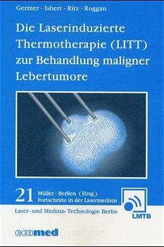 Die Laserinduzierte Thermotherapie (LITT) zur Behandlung maligner Lebertumore - Christoph Th Germer, J P Ritz, C Isbert, André Roggan