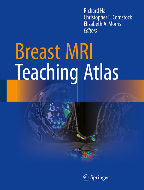 Breast MRI Teaching Atlas - 