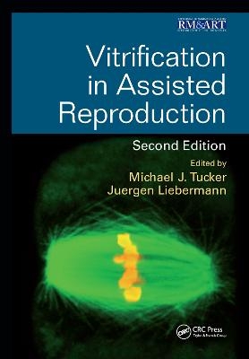 Vitrification in Assisted Reproduction - 