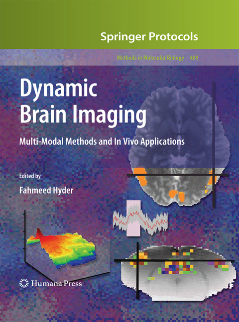 Dynamic Brain Imaging - 