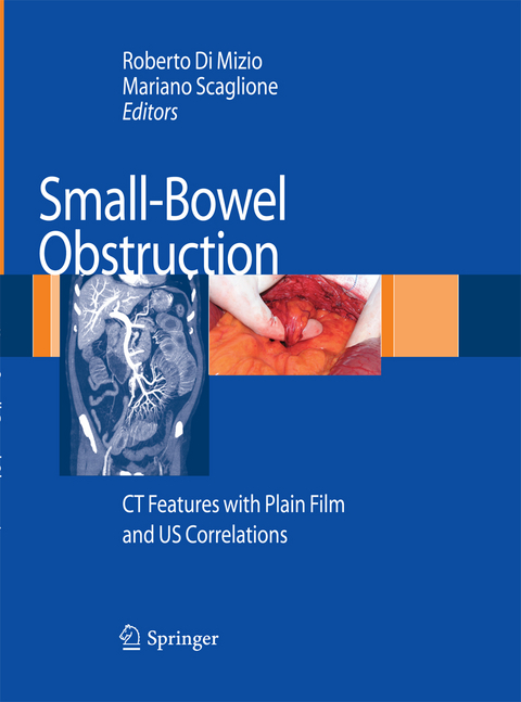 Small-Bowel Obstruction - 