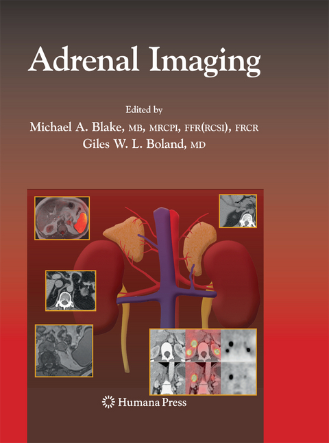 Adrenal Imaging - 