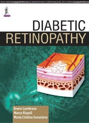 Diabetic Retinopathy - Bruno Lumbroso, Marco Rispoli, Maria Cristina Savastano