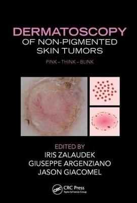 Dermatoscopy of Non-Pigmented Skin Tumors - 