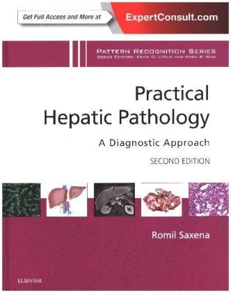 Practical Hepatic Pathology: A Diagnostic Approach E-Book -  Romil Saxena