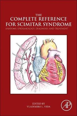 Complete Reference for Scimitar Syndrome - 