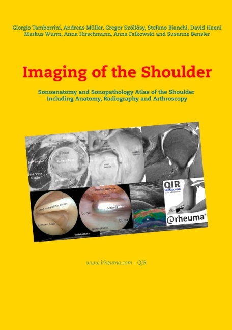 Imaging of the Shoulder - Giorgio Tamborrini, Andreas Müller, Gregor Szöllösy, Stefano Bianchi, David Haeni, Markus Wurm, Anna Hirschmann, Anna Falkowski, Susanne Bensler