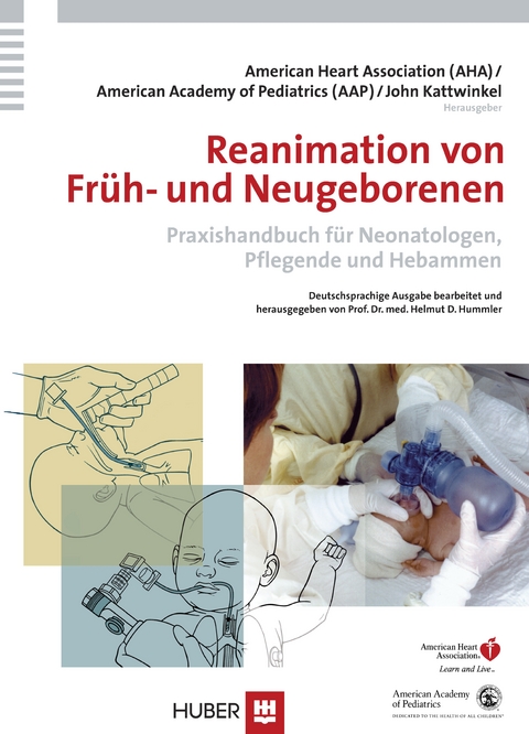 Reanimation von Früh- und Neugeborenen - 