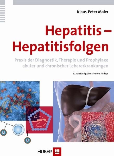 Hepatitis - Hepatitisfolgen - Klaus-Peter Maier