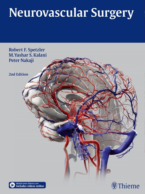 Neurovascular Surgery - 