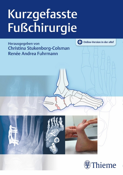 Kurzgefasste Fußchirurgie - 