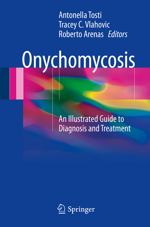 Onychomycosis - 