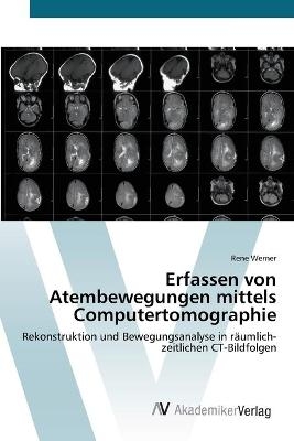 Erfassen von Atembewegungen mittels Computertomographie - Rene Werner